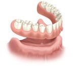 Lower dentures rest on your jaw, held in place by gravity.