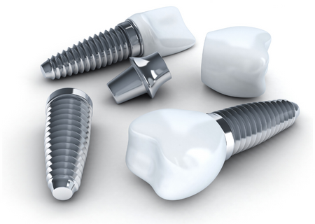 Dental implant components, including the post, abutment, and crown