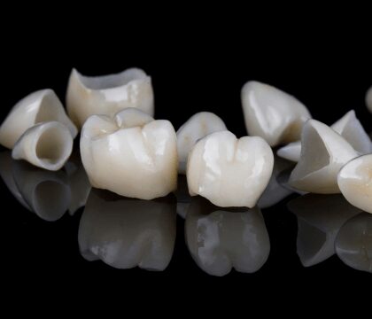 Ten dental crowns for various tooth positions on black glass